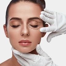 Eyelid surgery