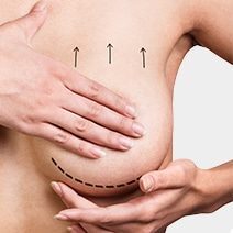 Breast Reduction