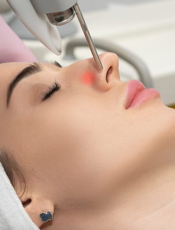 How to remove scars with laser How to remove scars with laser
