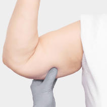 Brachioplasty